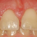 Dr. Vasanthan periodontist cases